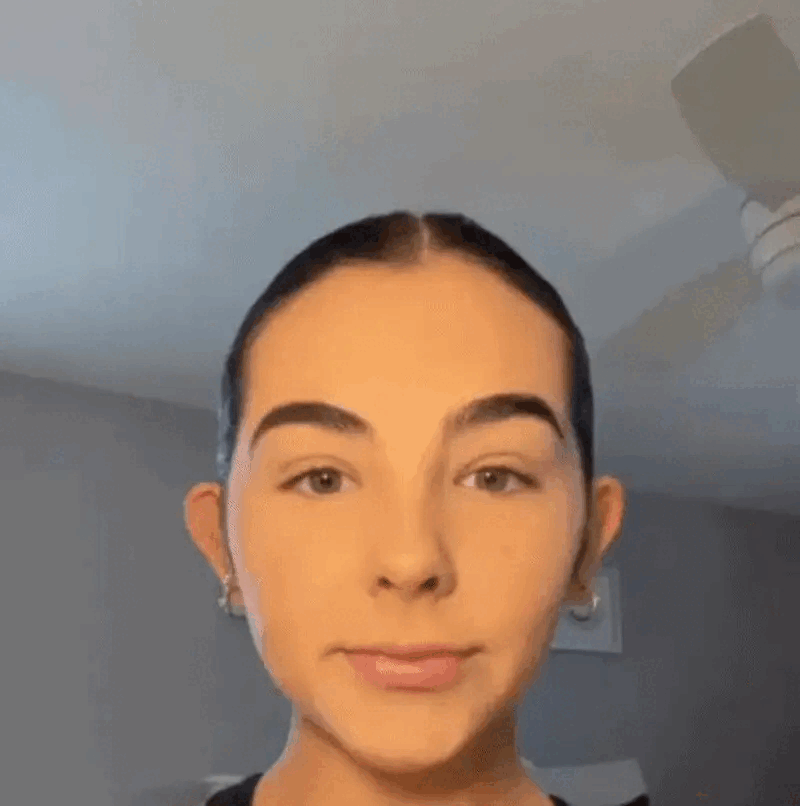 Invisible EarGlow™ korekcija ušiju