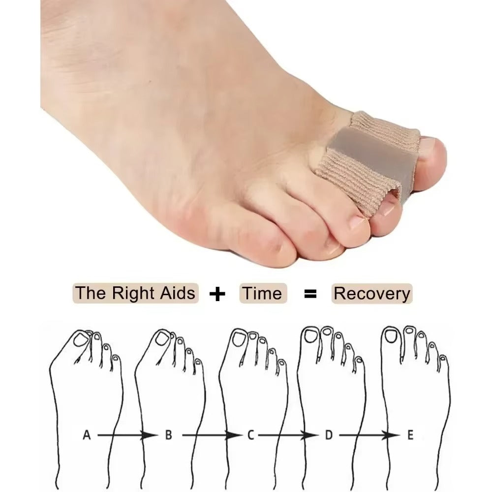 ComfortStride™ rukavi za poravnavanje prstiju