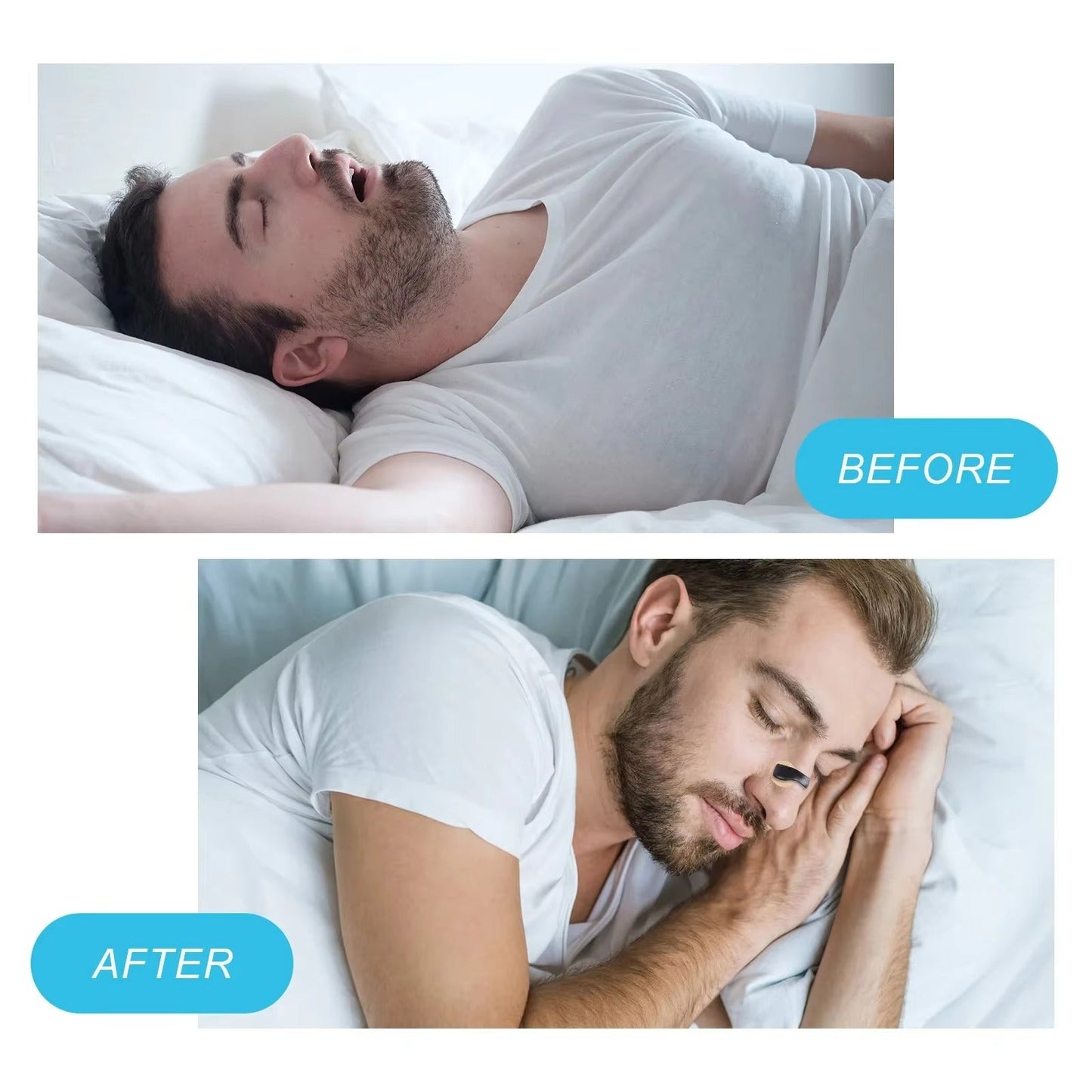 NoSnore Pro™ magnetski ekstenzor za nos
