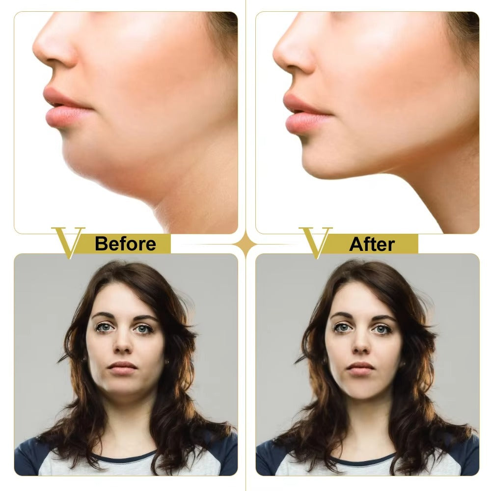 ContourLift V maske za učvršćivanje kože