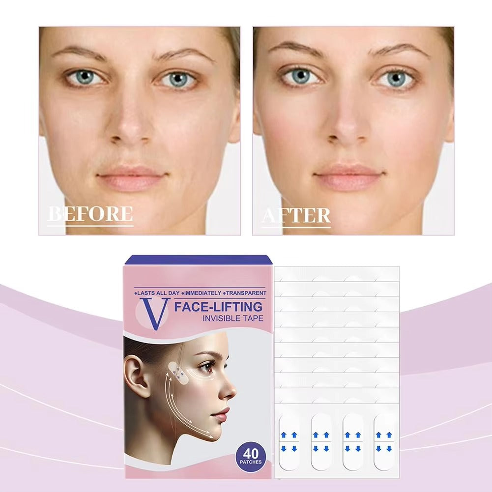Luma Lift™ V traka za lifting lica