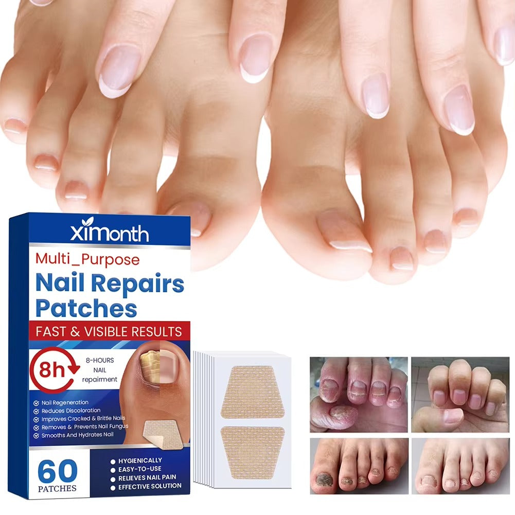 NailNurture™ flasteri za noćni popravak protiv gljivica na noktima