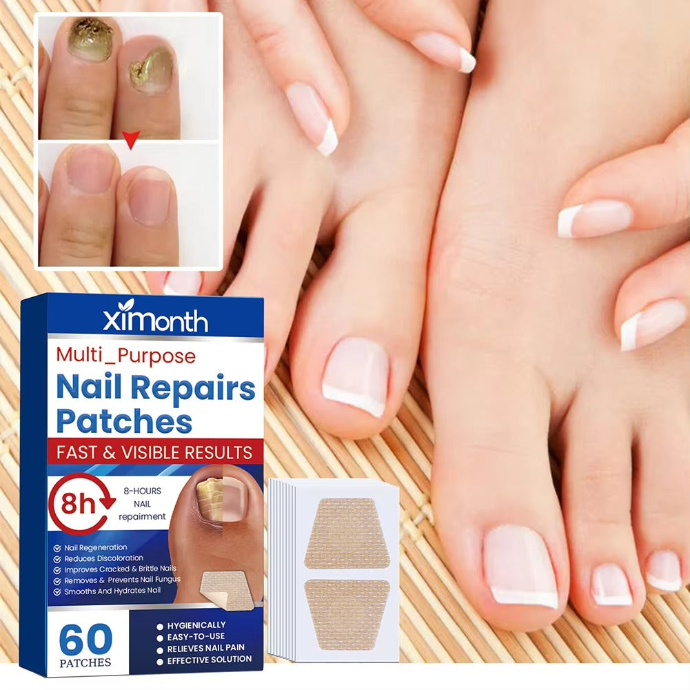 NailNurture™ flasteri za noćni popravak protiv gljivica na noktima