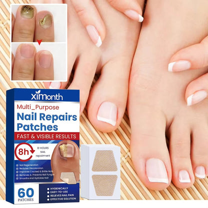NailNurture™ flasteri za noćni popravak protiv gljivica na noktima