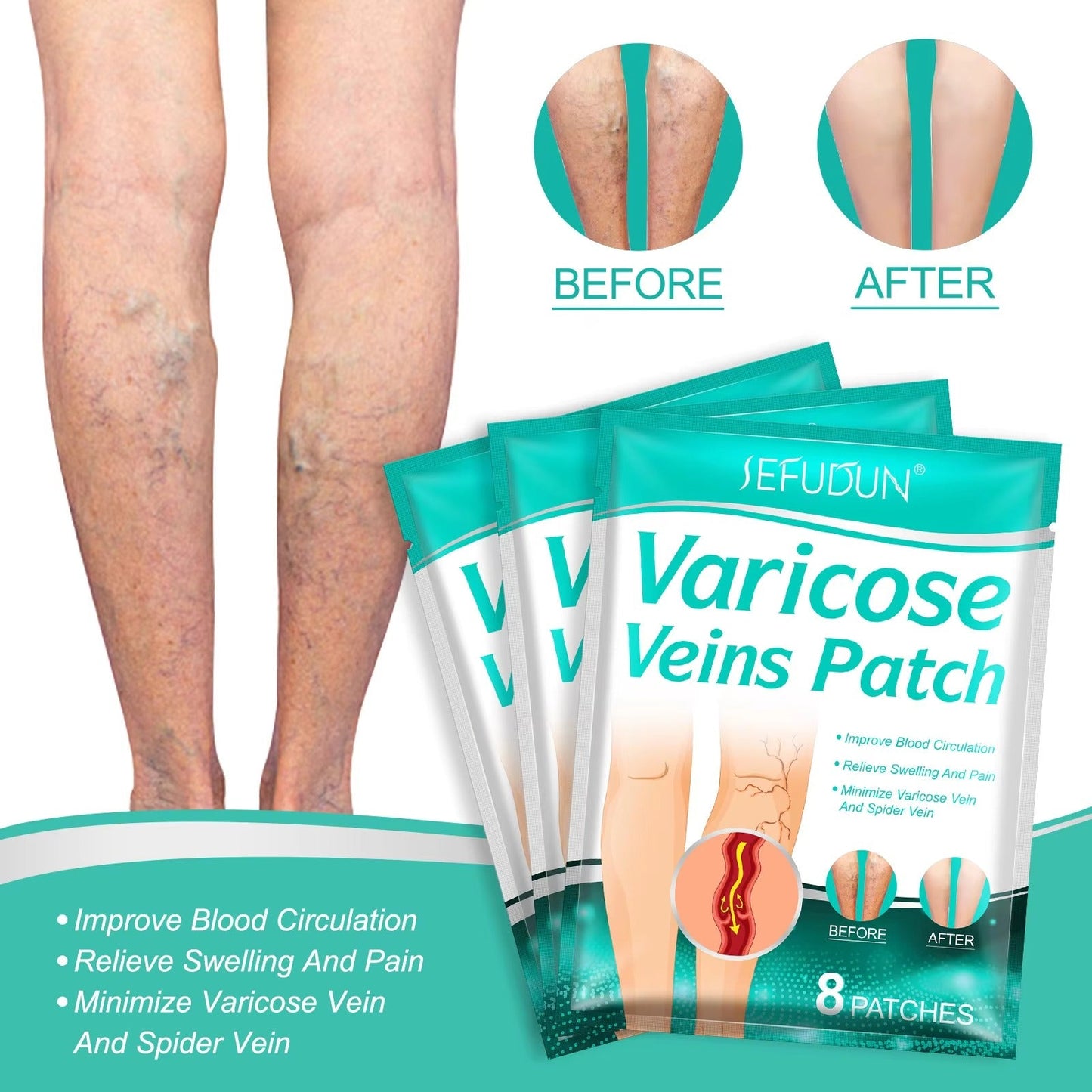 VeinEase™ flaster za proširene vene