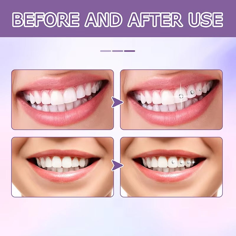 ToothGlam™ Sjaj sa svakim osmijehom