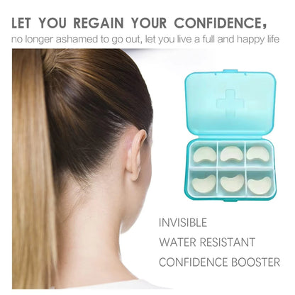 Invisible EarGlow™ korekcija ušiju